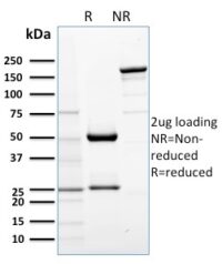 Data from SDS-PAGE analysis of Anti-AKT1 antibody (Clone AKT1/2552). Reducing lane (R) shows heavy and light chain fragments. NR lane shows intact antibody with expected MW of approximately 150 kDa. The data are consistent with a high purity, intact mAb.